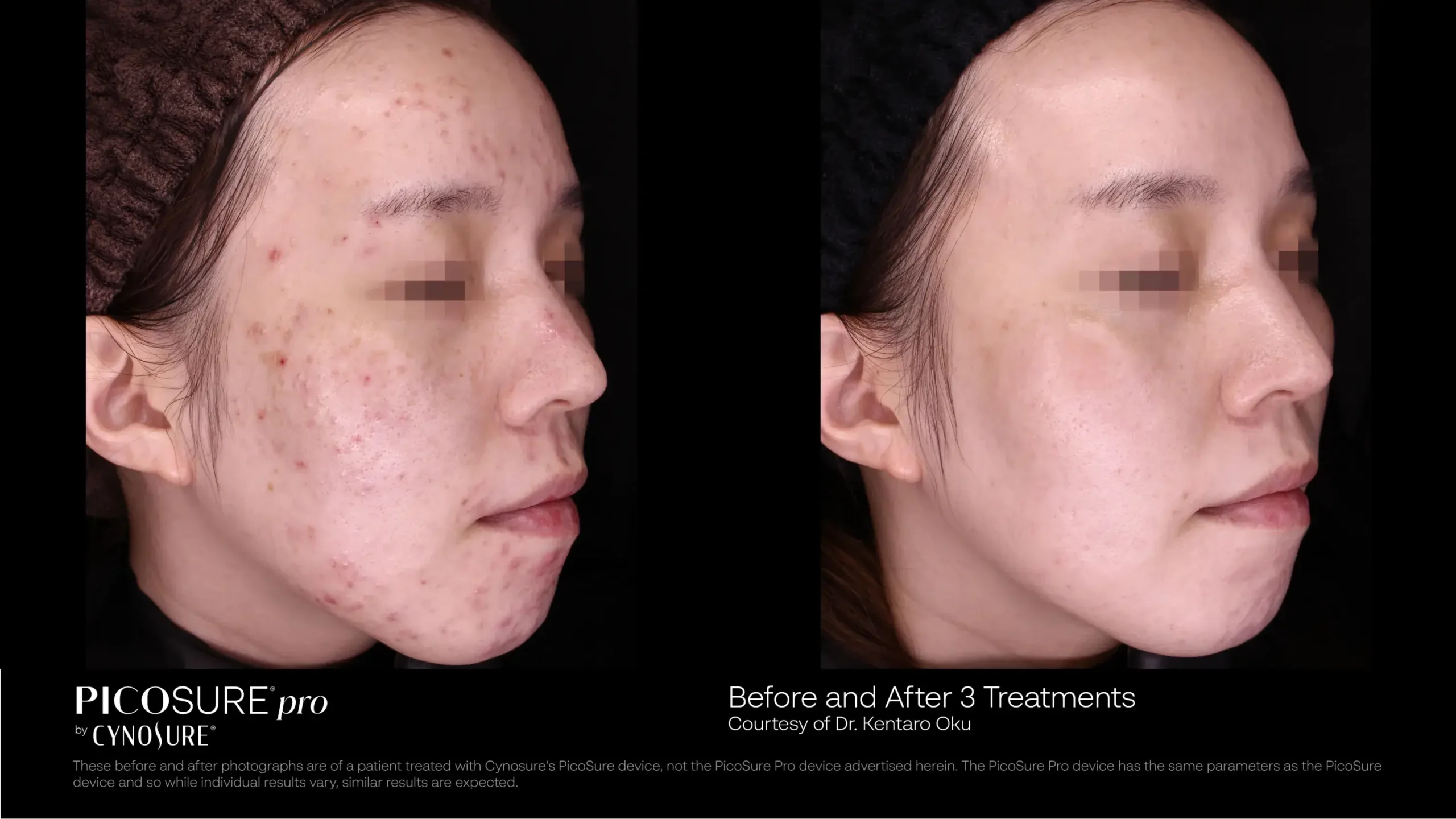 66cce1ee16bc364be283cf5d_before-after-14
