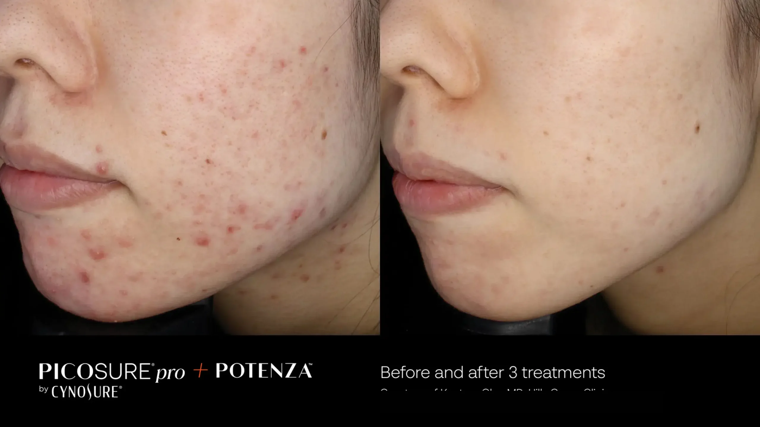 66cceba0d220e585924dc546_potenza-before-after-09