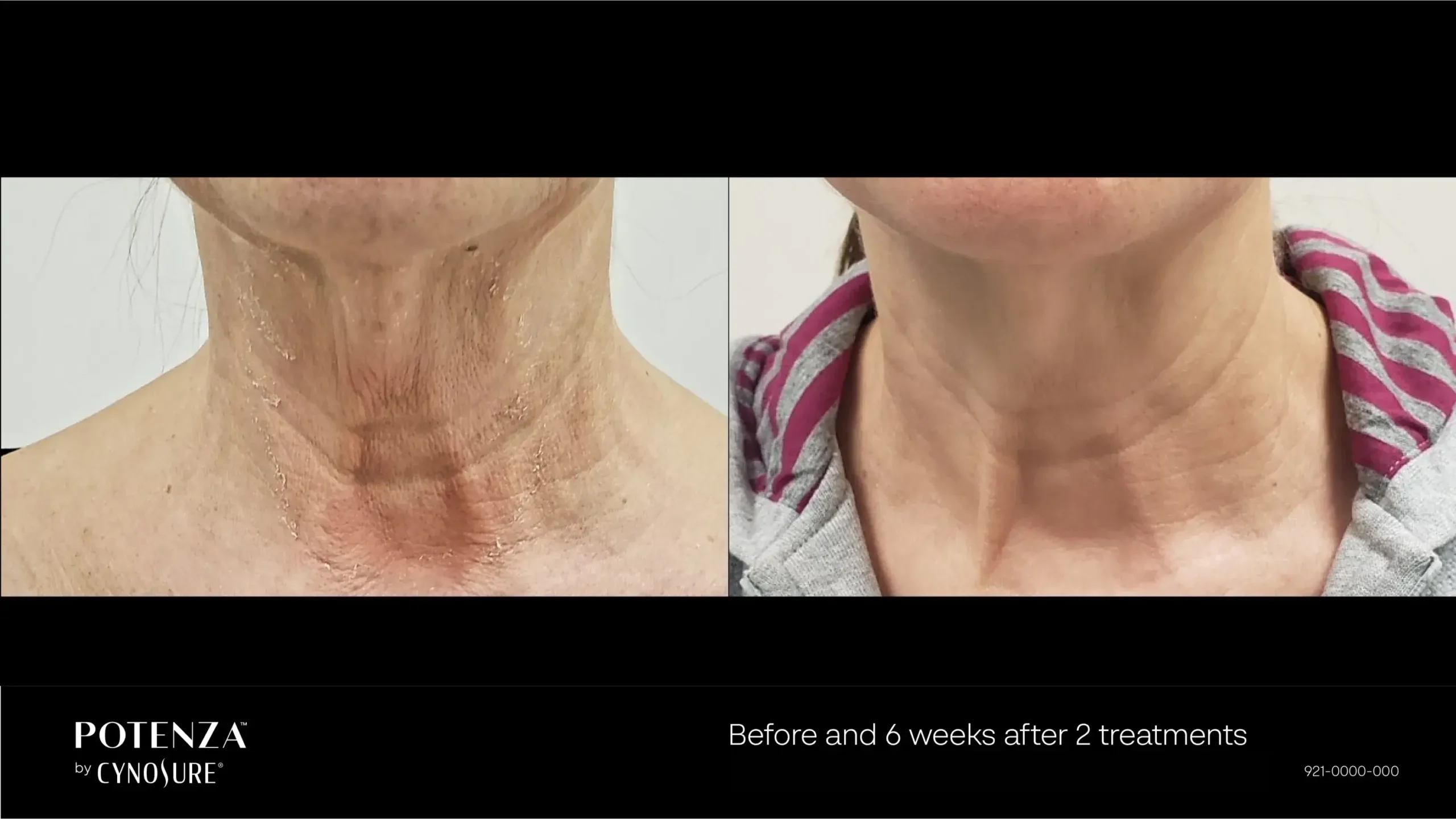 66cceba0dd07e829cad22670_potenza-before-after-07